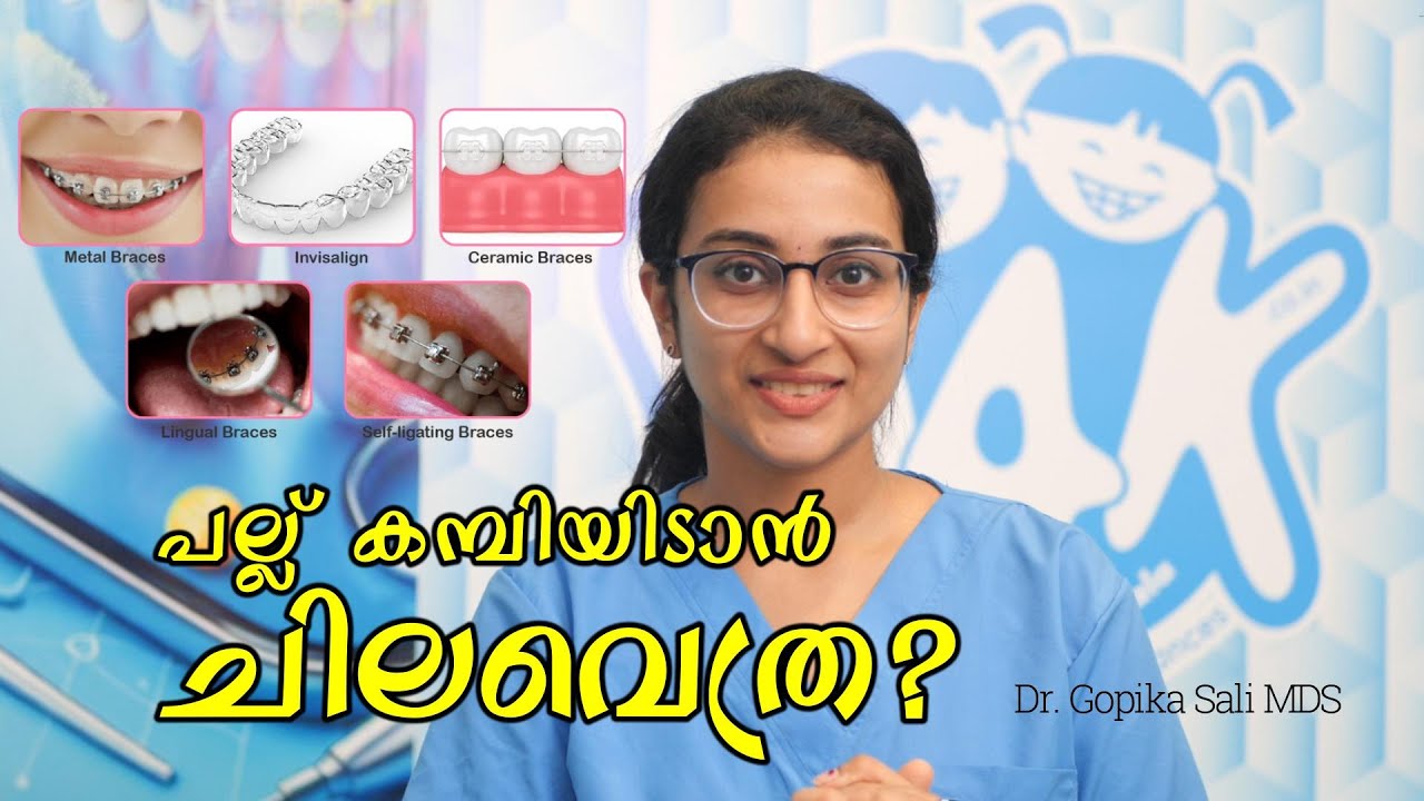 Affordable | Metal braces | Ceramic Teeth Braces | Clear Teeth Aligners Cost in Kochi, Kerala, India