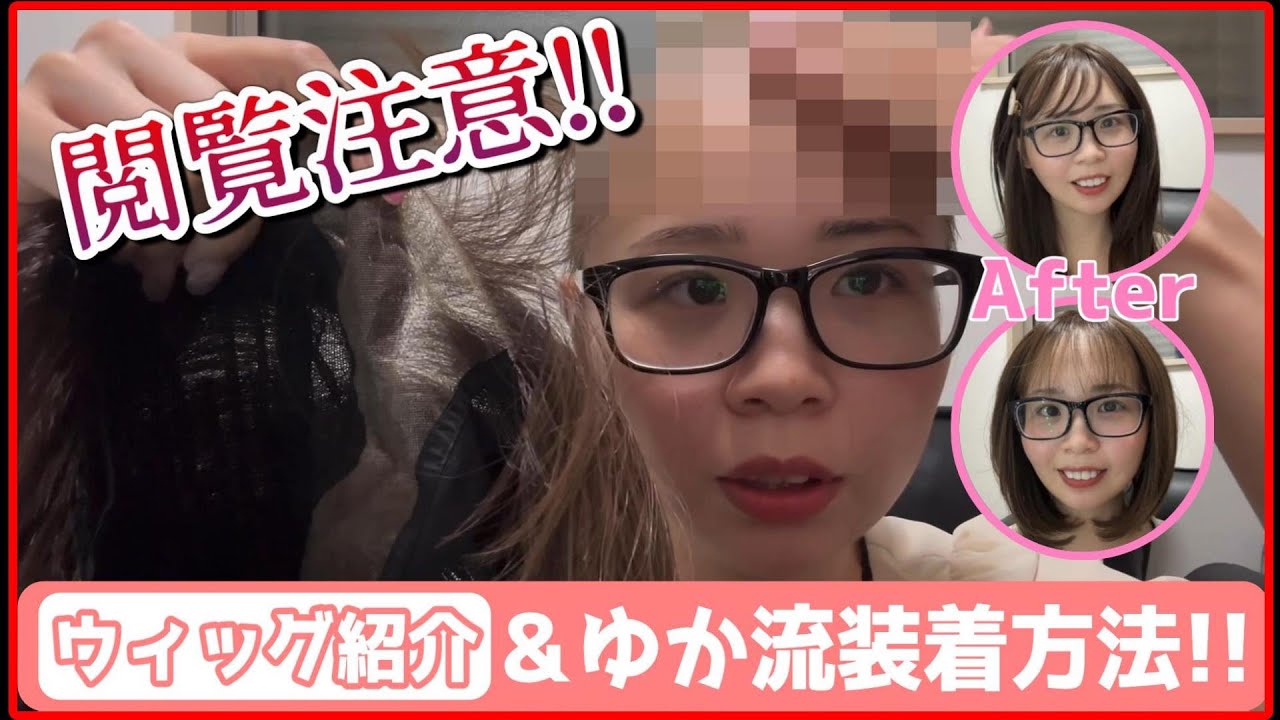 【円形脱毛症・びまん性脱毛症】※閲覧注意⚠️坊主女おすすめウィッグで大変身🌈#pinkage
