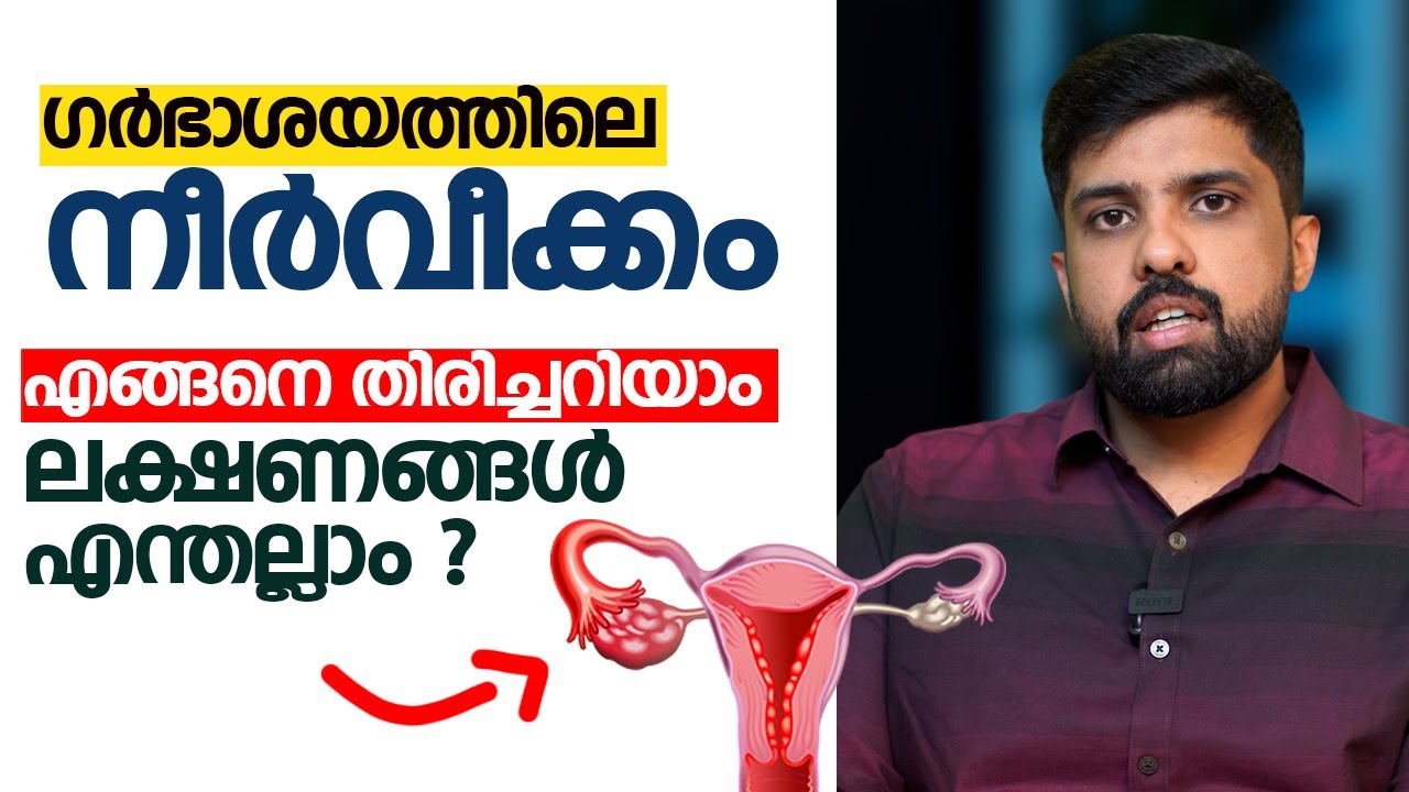 ഗർഭാശയത്തിൽ നീർവീക്കം ഉണ്ടോ ? എങ്ങനെ തിരിച്ചറിയാം ? ലക്ഷണങ്ങൾ എന്തല്ലാം ?