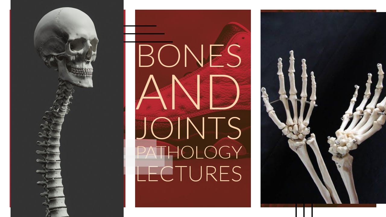 BONES AND JOINTS PATHOLOGY lecture 11 RHEUMATOID ARTHRITIS detailed and easiest explanation