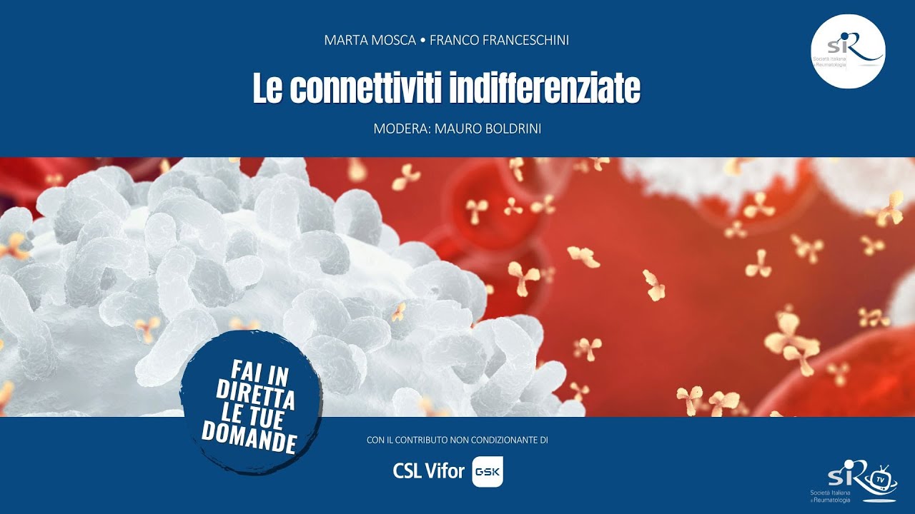 Le connettiviti indifferenziate