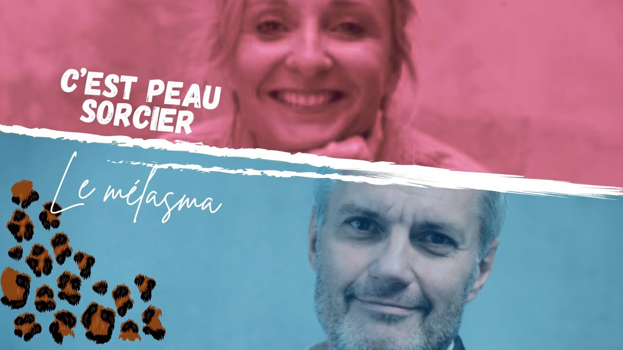 C'est Peau Sorcier : le mélasma