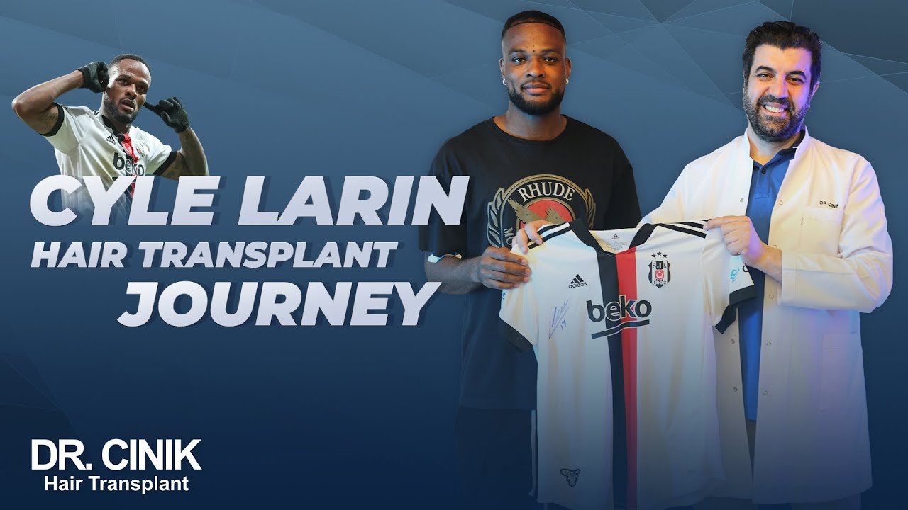 Cyle Larin Hair Transplant Journey | Dr. Cinik Hair Hospital