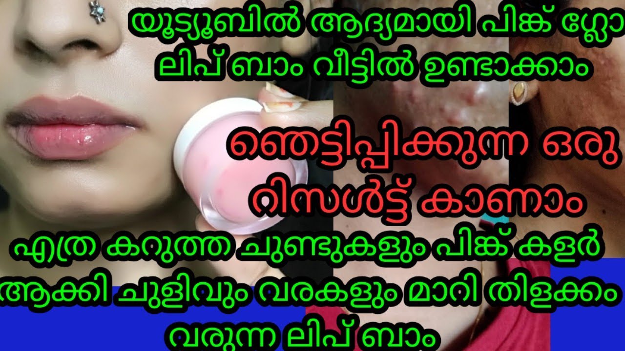 ഒരു വലിയ റിസൾട്ട്‌ കാണാം ചുണ്ടിലെ കറുപ്പും ചുളിവും മാറ്റാൻ പിങ്ക് ഗ്ലോ ലിപ് ബാം വീട്ടിൽ ഉണ്ടാക്കാം