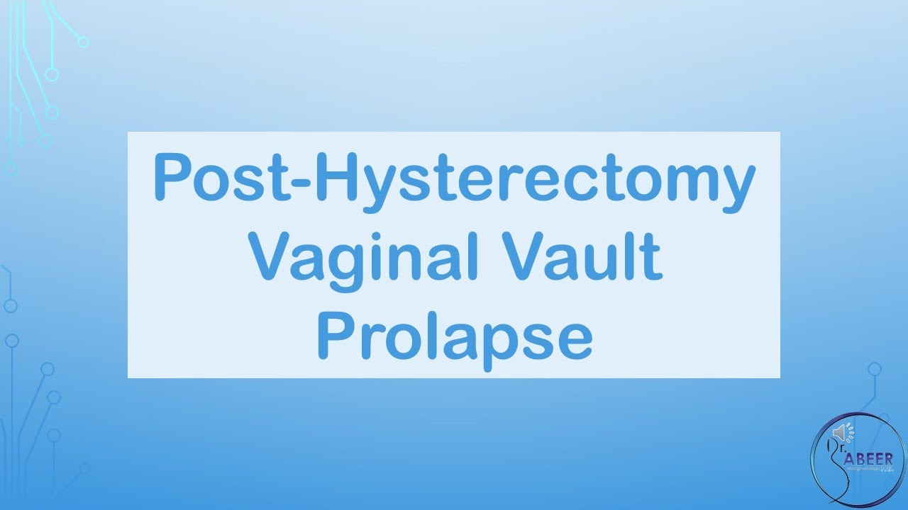 RCOG GUIDELINE POST HYSTERECTOMY VAGINAL VAULT PROLAPSE