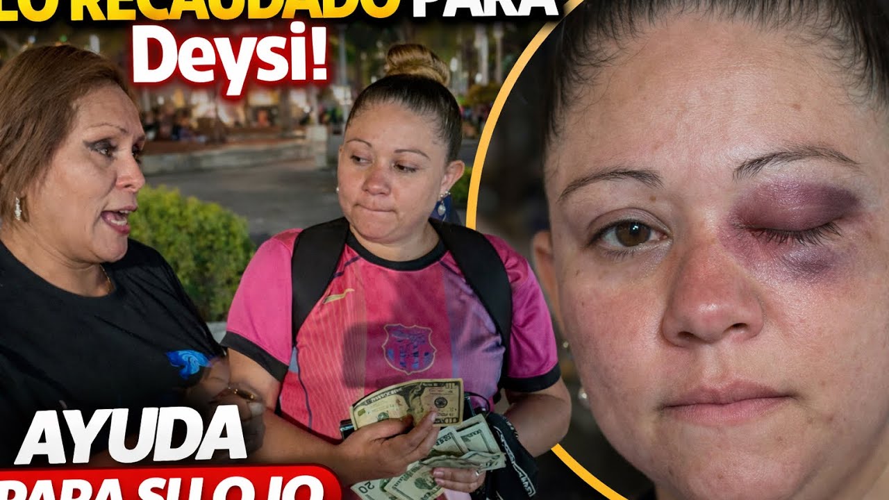 ESTO LLEGÓ PARA LO DEL OJO PARA DEYSI 
