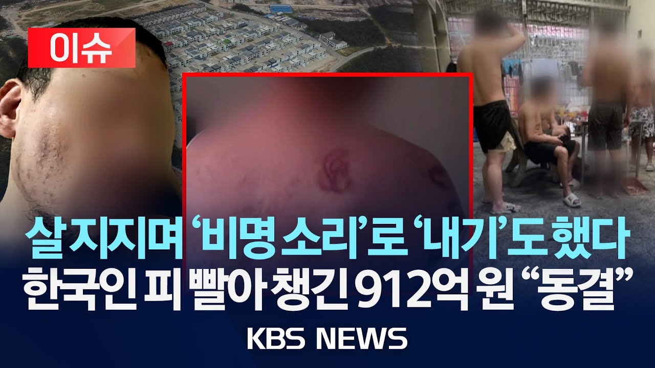 [이슈] 살 지지며 '비명 소리'로 '내기'도 했다...한국인 피 빨아 챙긴 912억 원 