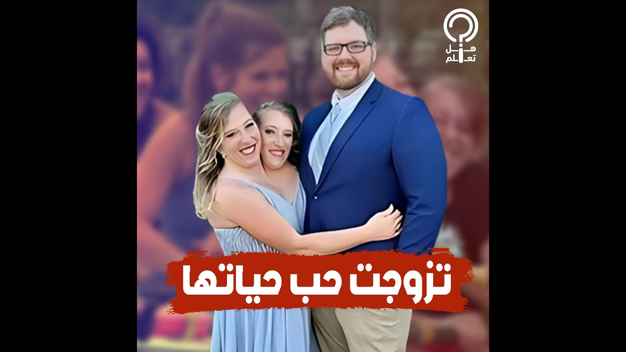 الفيديو الأول لزواج التوأم الملتصق الوحيد من نوعه في العالم.. إحداهما كانت تحبه جدا