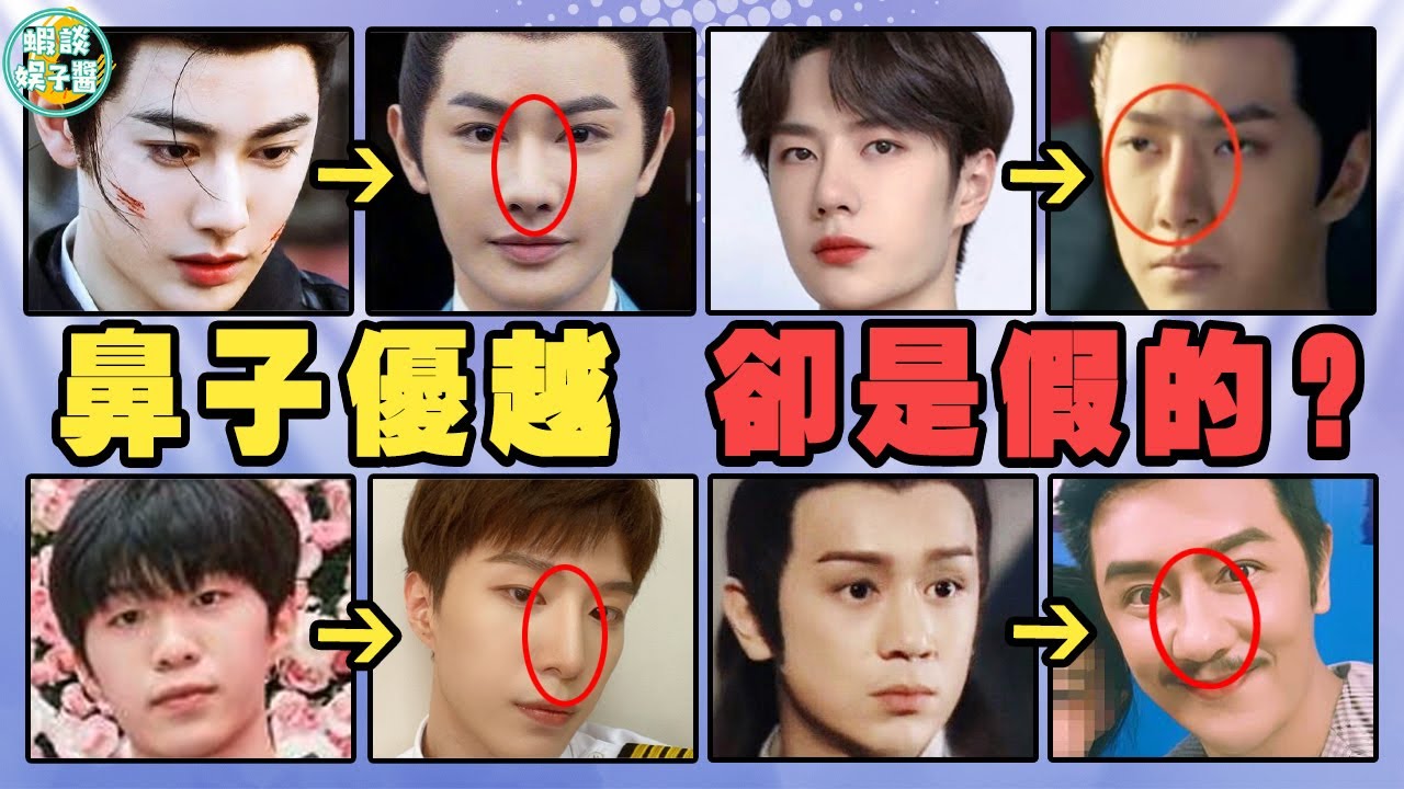 那些亂整鼻子的男星還好嗎？後遺症一大堆！王一博王佑碩都開始崩了？王一博，孙坚，范丞丞，范冰冰，洪欣，莫少聪，张镐濂，陈浩民，肖骁，李豪，王佑硕，夏之光