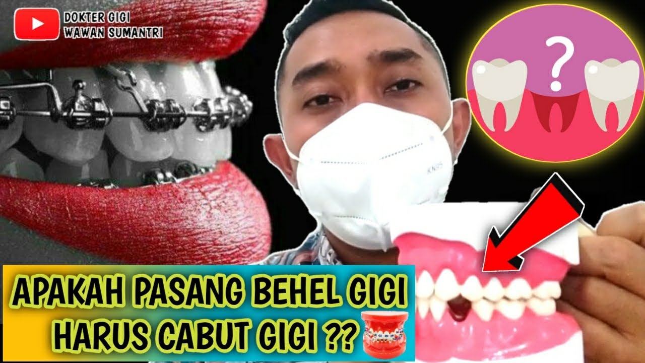 PASANG BEHEL GIGI HARUS CABUT GIGI DULU ? #behelgigi #pasangbehel #kawatgigi #dentist #doktergigi