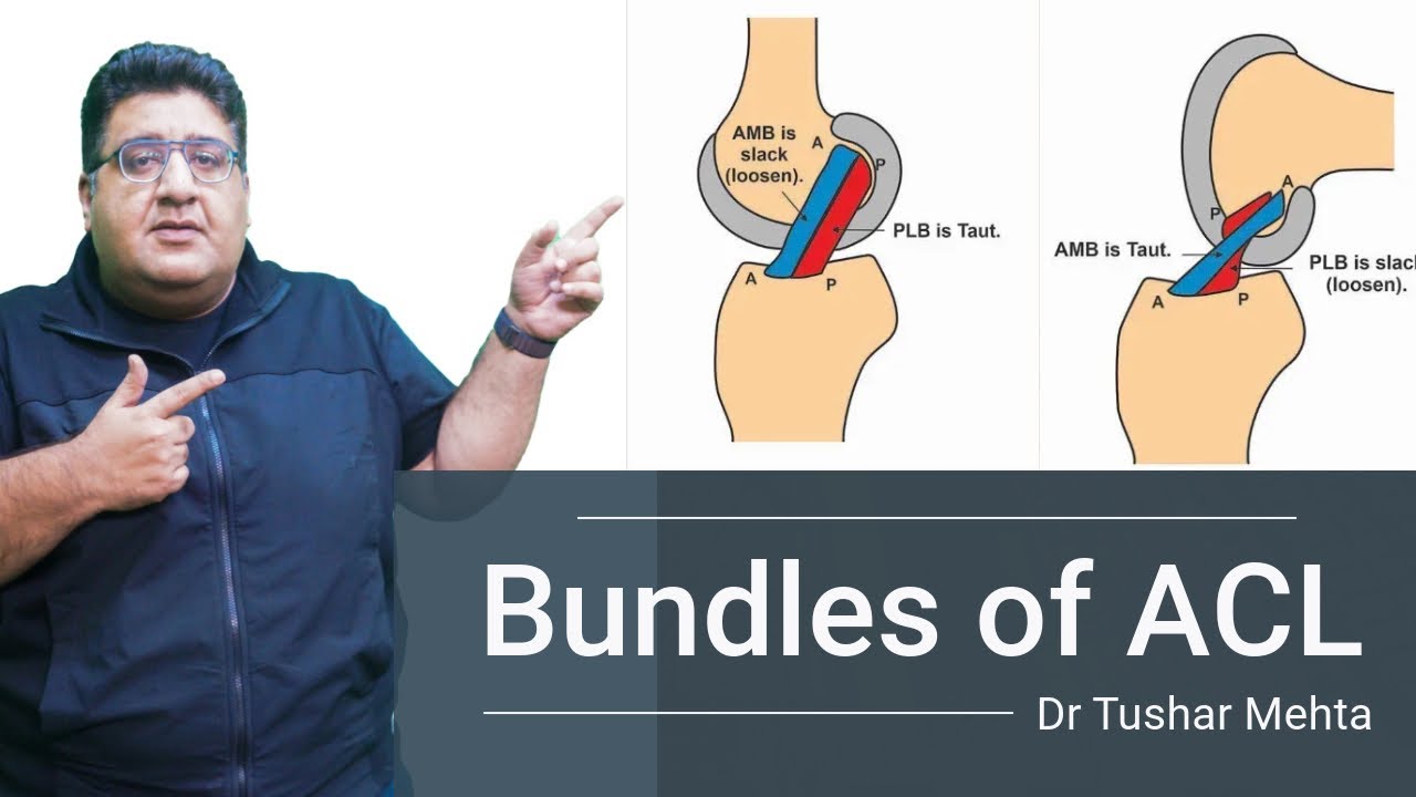 Bundles of Anterior Cruciate Ligament | 