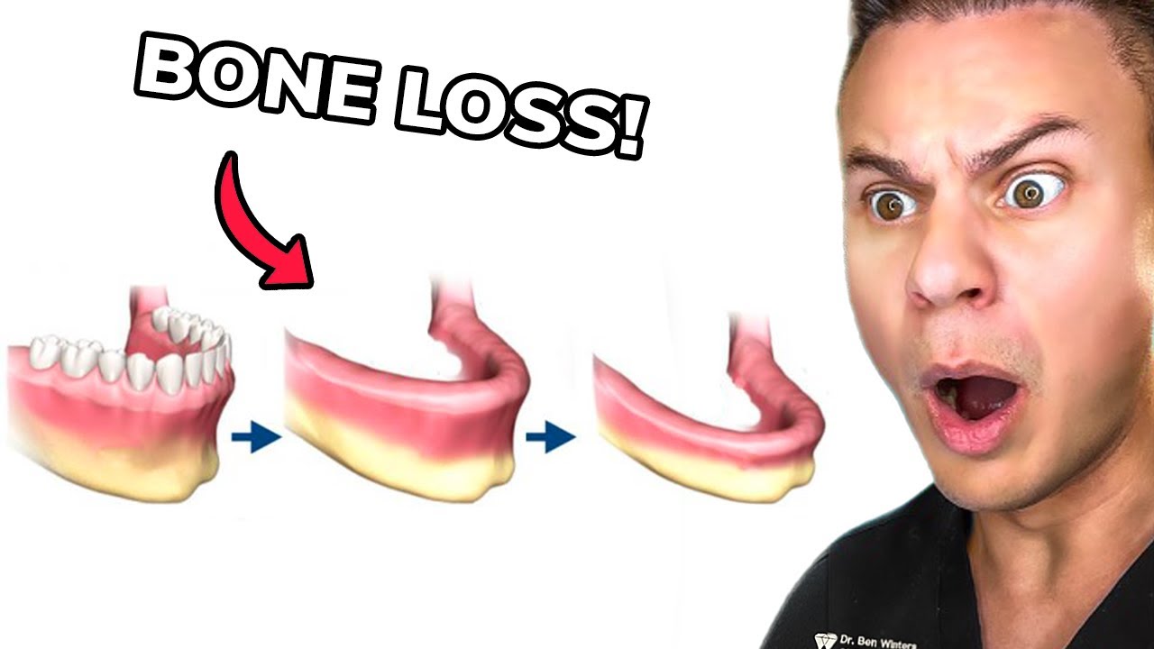 Knowing THIS About Dentures Could Change Your Life!