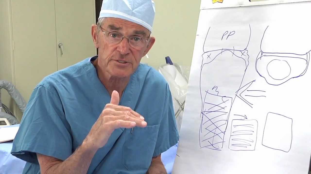 Protected Position of the Hand