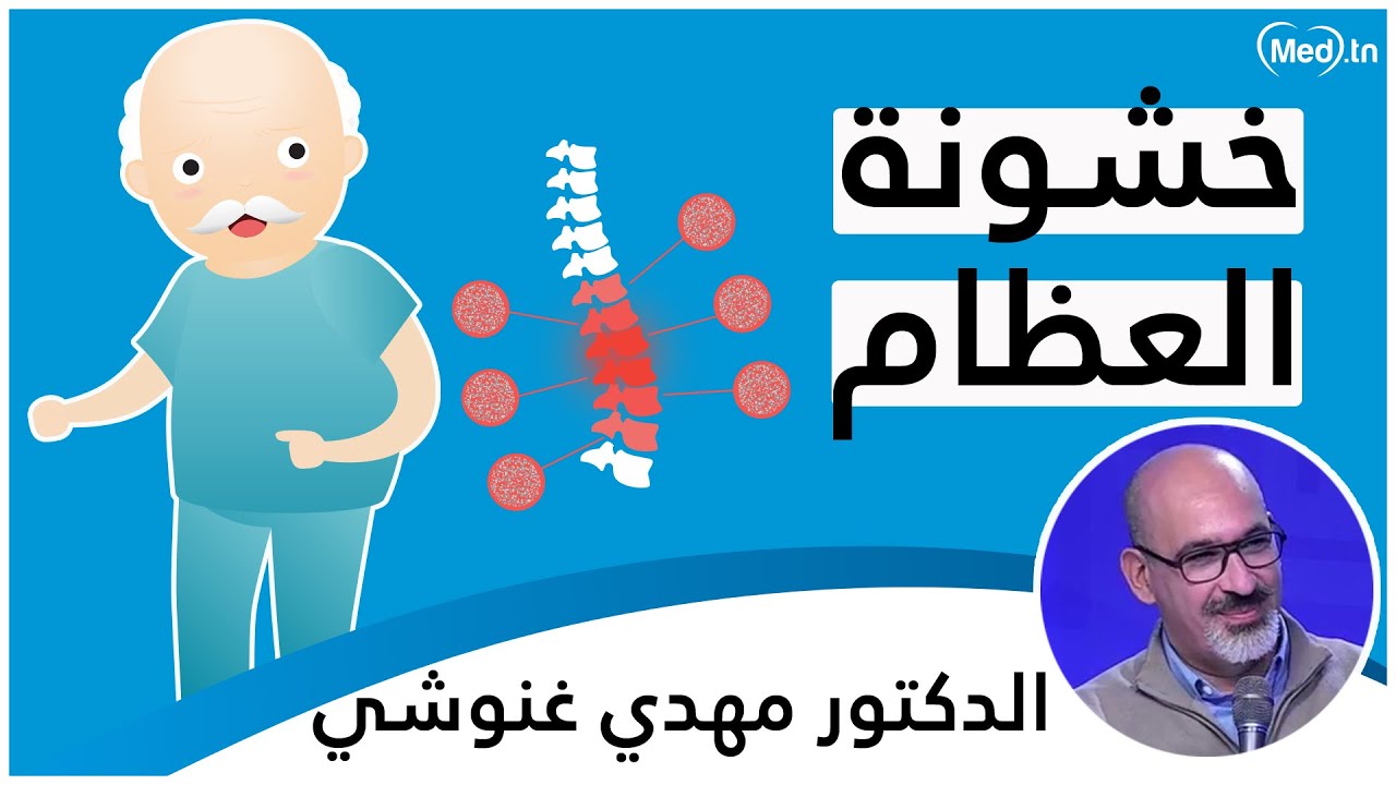 خشونة العظام | الدكتور مهدي غنوشي