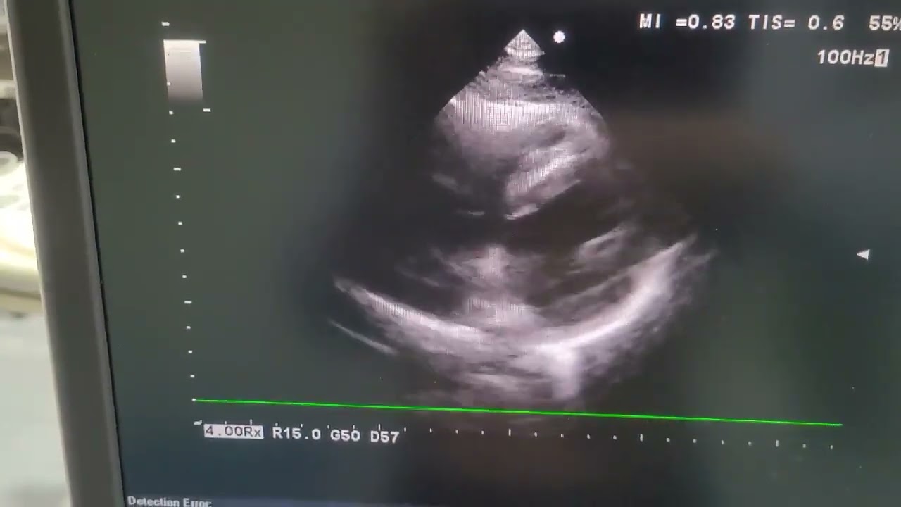 Aloka Hitachi  F37 Ultrasound Convex Linear Cardiac System