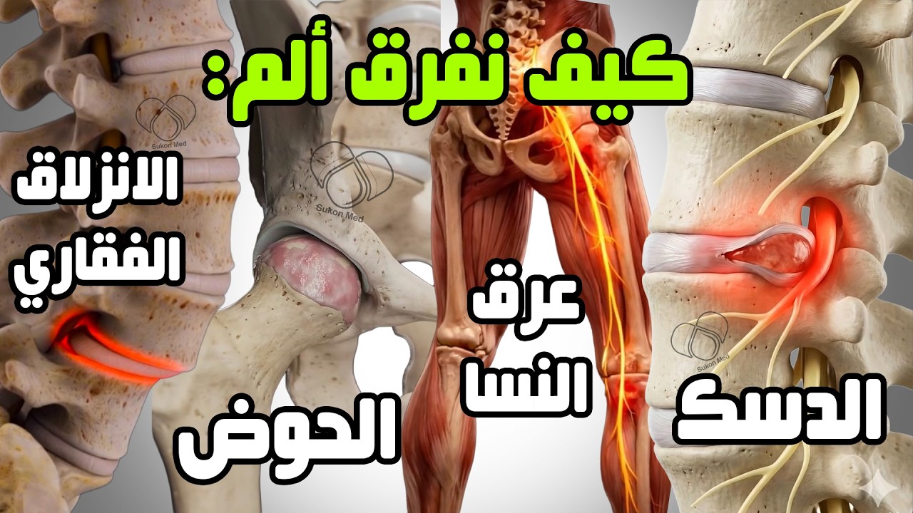 اختبار تشخيص أنواع ألم الظهر: شد عضلي | عرق النسا | دسك | انزلاق الفقاري | الم الورك