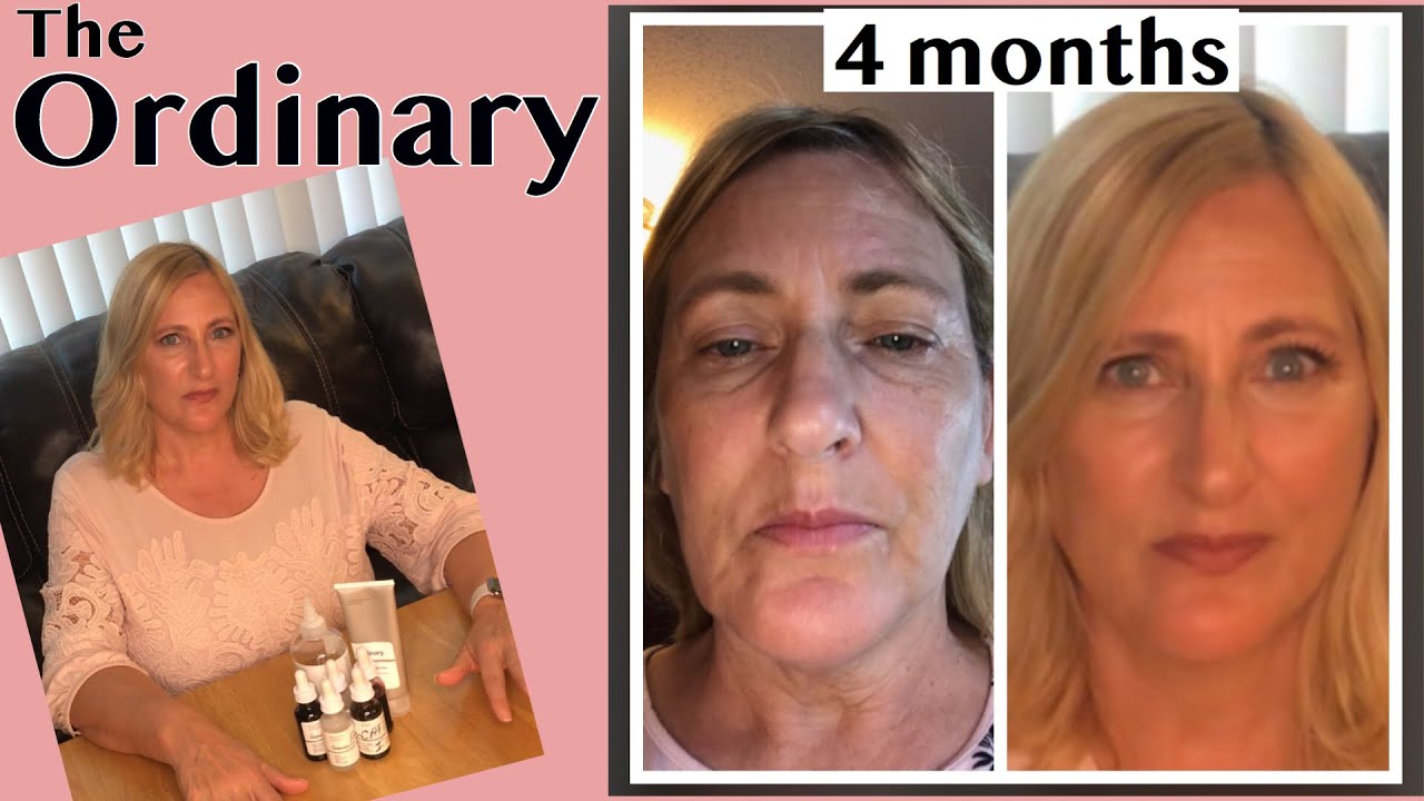 The Ordinary Part 1 - What to buy in your first order - Mature Skin Care