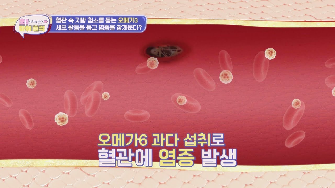 뇌와 심장 혈관에 직격타💥 오메가 3:6 불균형이 불러오는 끔찍한 일😨 | 오! 마이 홀릭 14회 | JTBC 250204 방송
