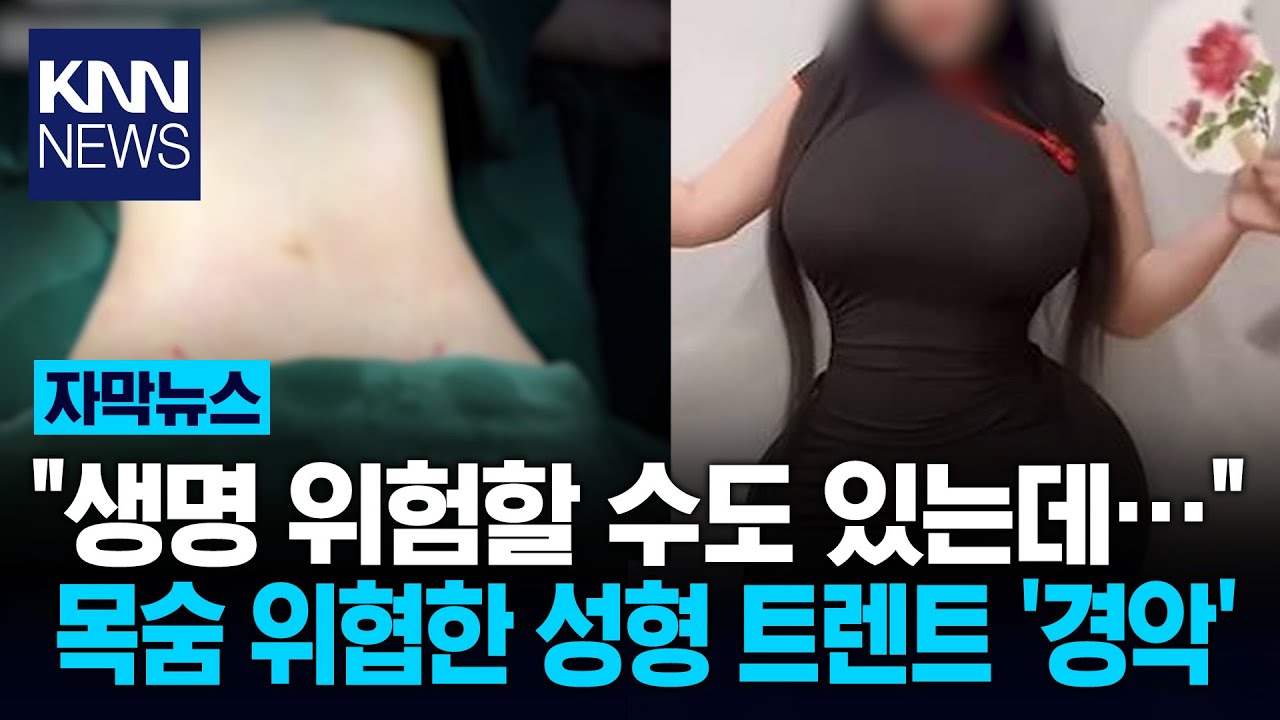 얇아지려고 갈비뼈까지 제거? '인어 허리'가 뭐길래? 경악/ KNN