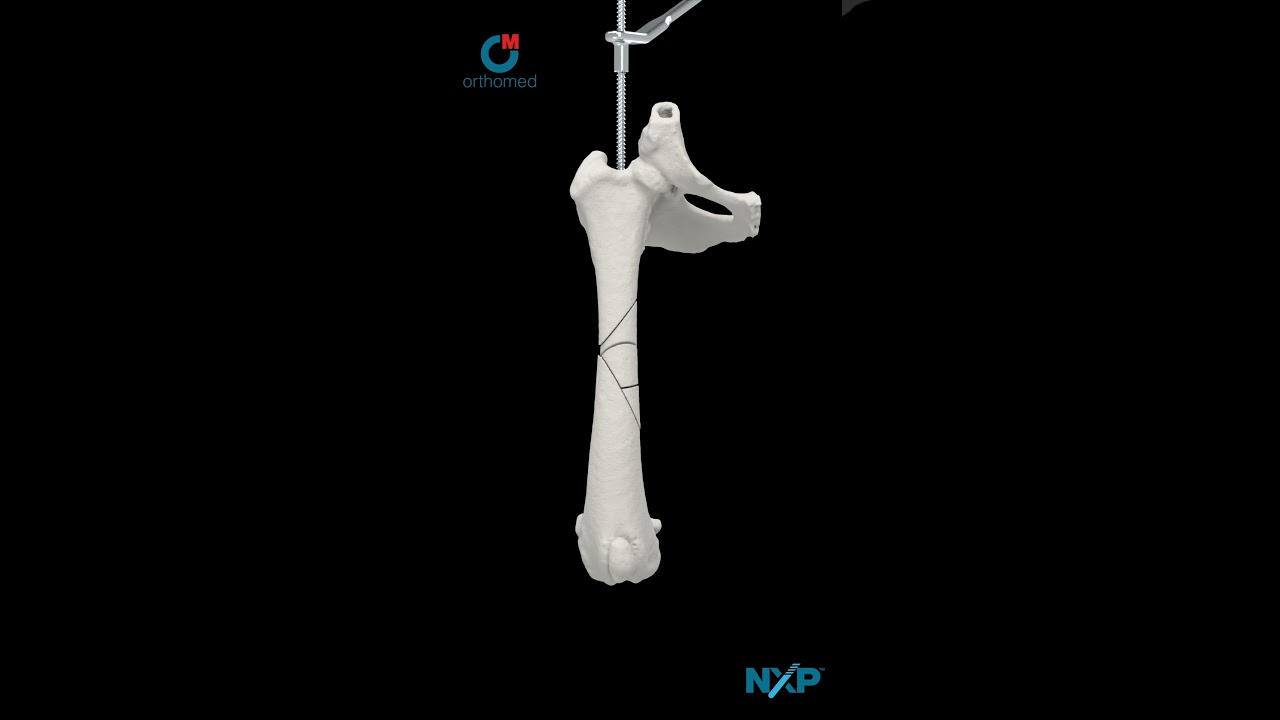 NXP™ - The Nexus Pin™
