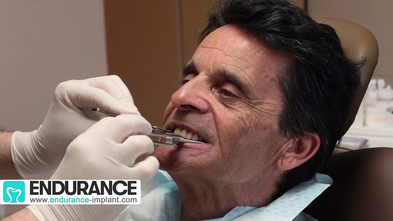 Prothèse amovible : Travail du dentiste et prothésiste - Dr SUBA Hongrie