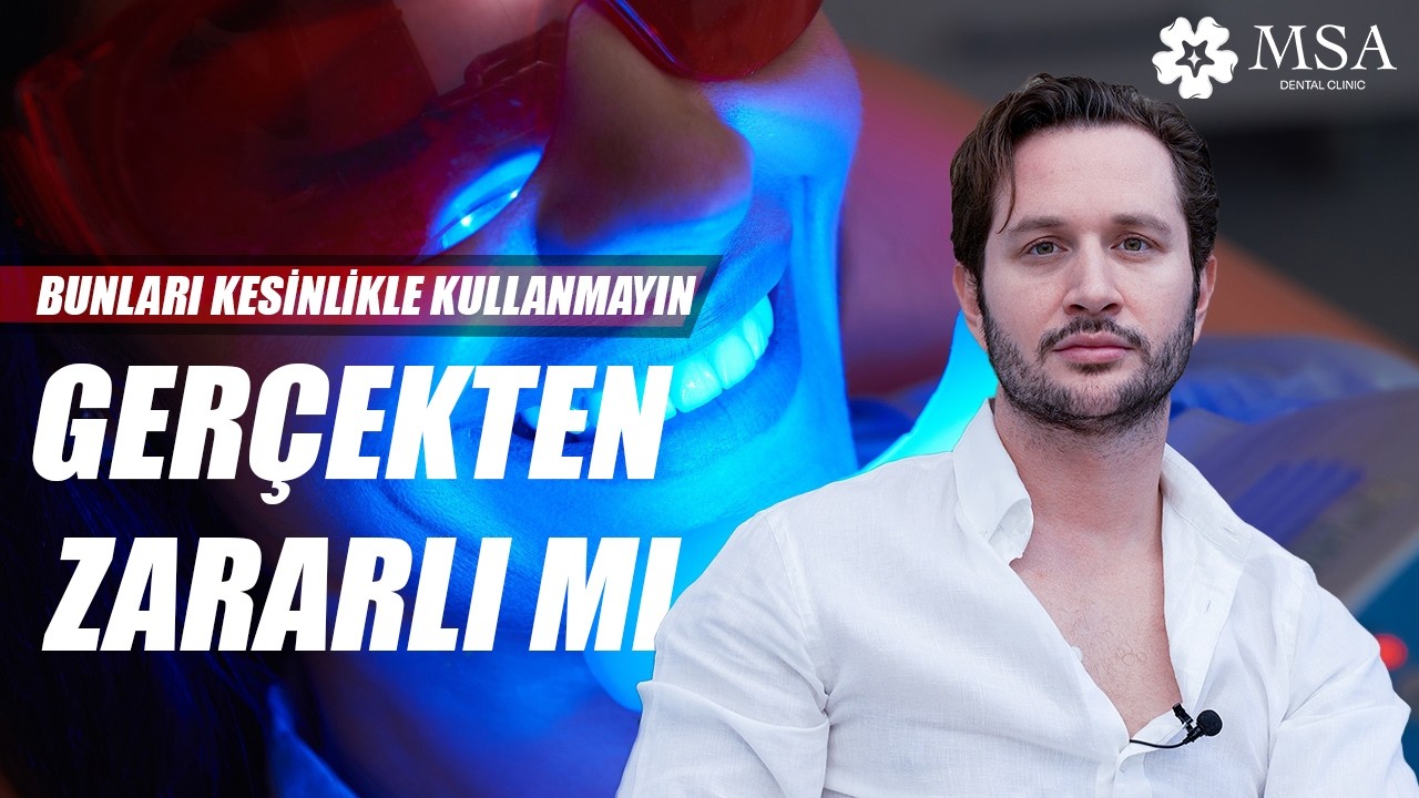 Diş Beyazlatma | Teeth Whitening-Bleaching | Zararlı Mı - Ev ve Ofis Tipi Diş Beyazlatma Yöntemleri