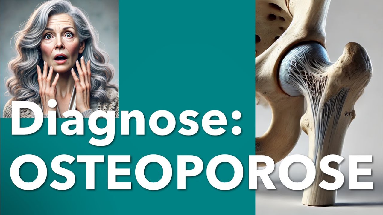 Osteoporose:  Was du jetzt wissen musst – Von der Diagnose zur Therapie