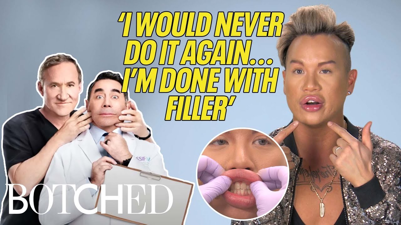 Jonathan's STRUGGLE With Such Big Lips: See Him Get His Filler Removed (w/ Results) | Botched | E!