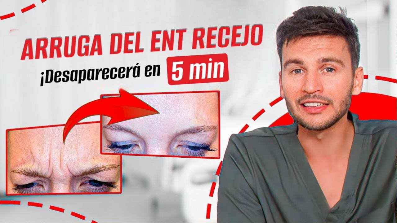 ¡DOS Ejercicios Efectivos para Eliminar las Líneas del Entrecejo!