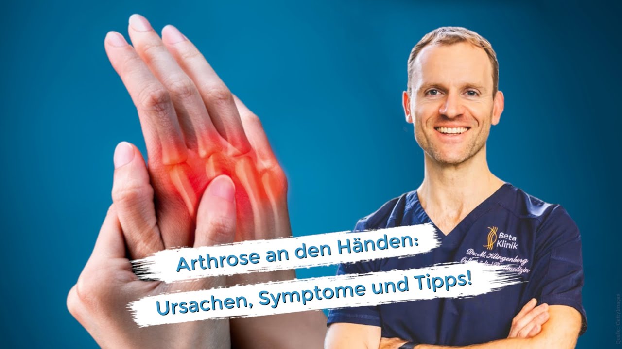 Arthrose an den Händen: Ursachen, Symptome und Hilfe bei Beschwerden!