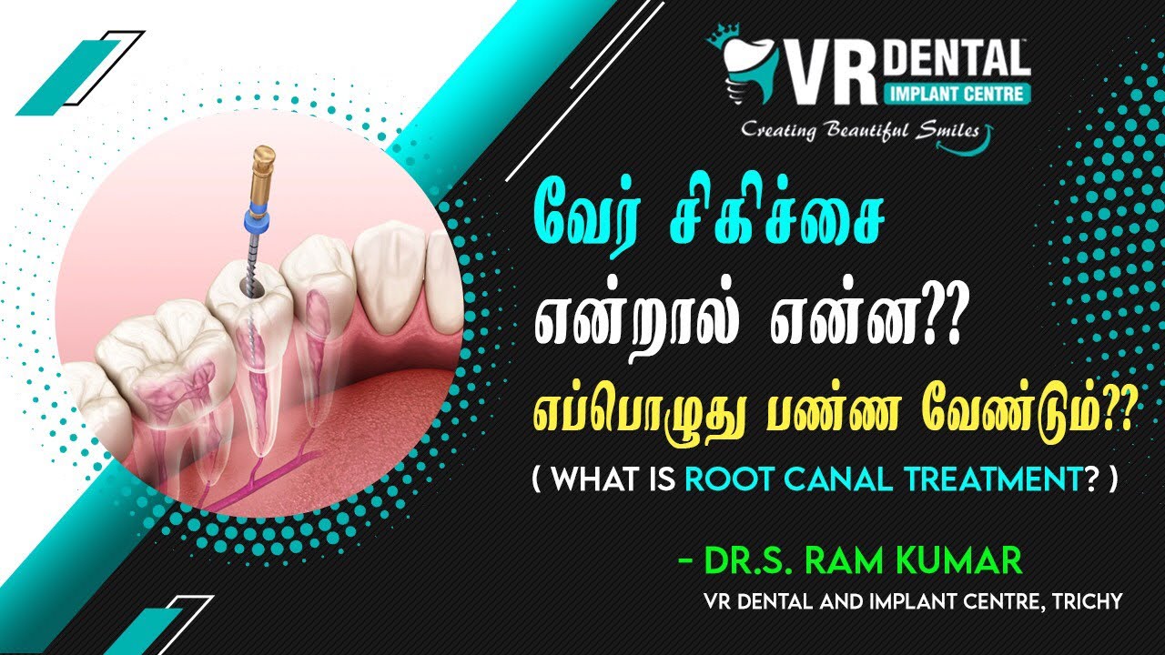 வேர் சிகிச்சை என்றால் என்ன?? ROOT CANAL TREATMENT IN TAMIL | VR DENTIST EXPLAINS.. | DR RAMKUMAR