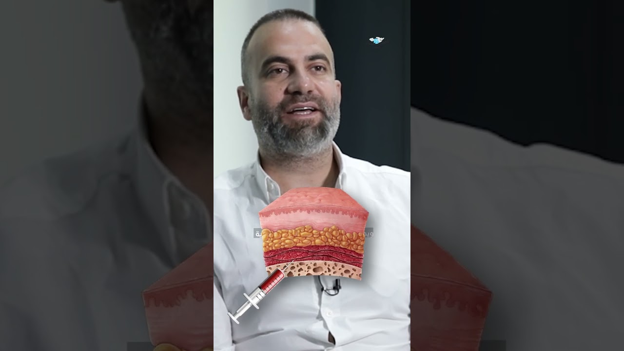 زيادة الطلب على جراحة شدّ المؤخرة البرازيلية: 