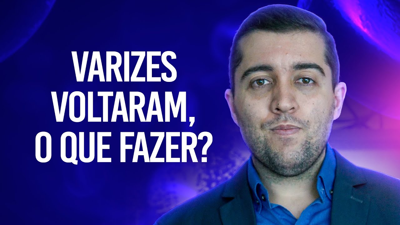 Como eliminar varizes e combater a m&aacute; circula&ccedil;&atilde;o para que elas n&atilde;o voltem e n&atilde;o virem uma trombose