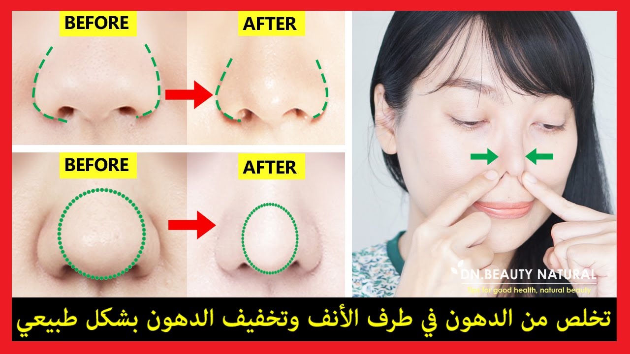 👃 كيفية التخلص من دهون الأنف ودهون أطراف الأنف ودهون أجنحة الأنف بشكل طبيعي