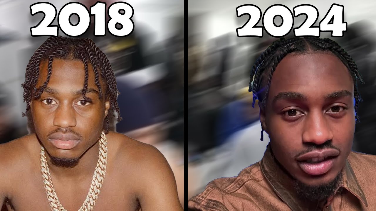 Why Does Lil Tjay's Hair Never Grow