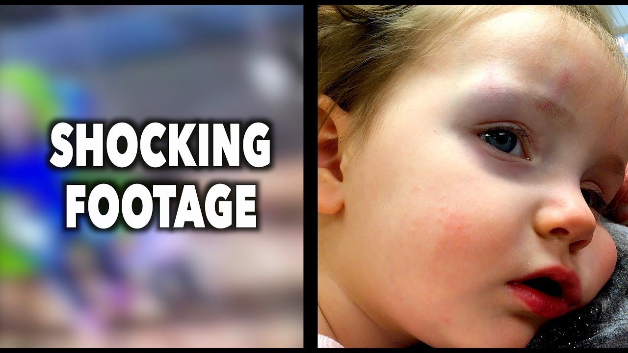SHE TOOK A MAJOR HIT TO THE HEAD (Shocking Footage) | Dr. Paul