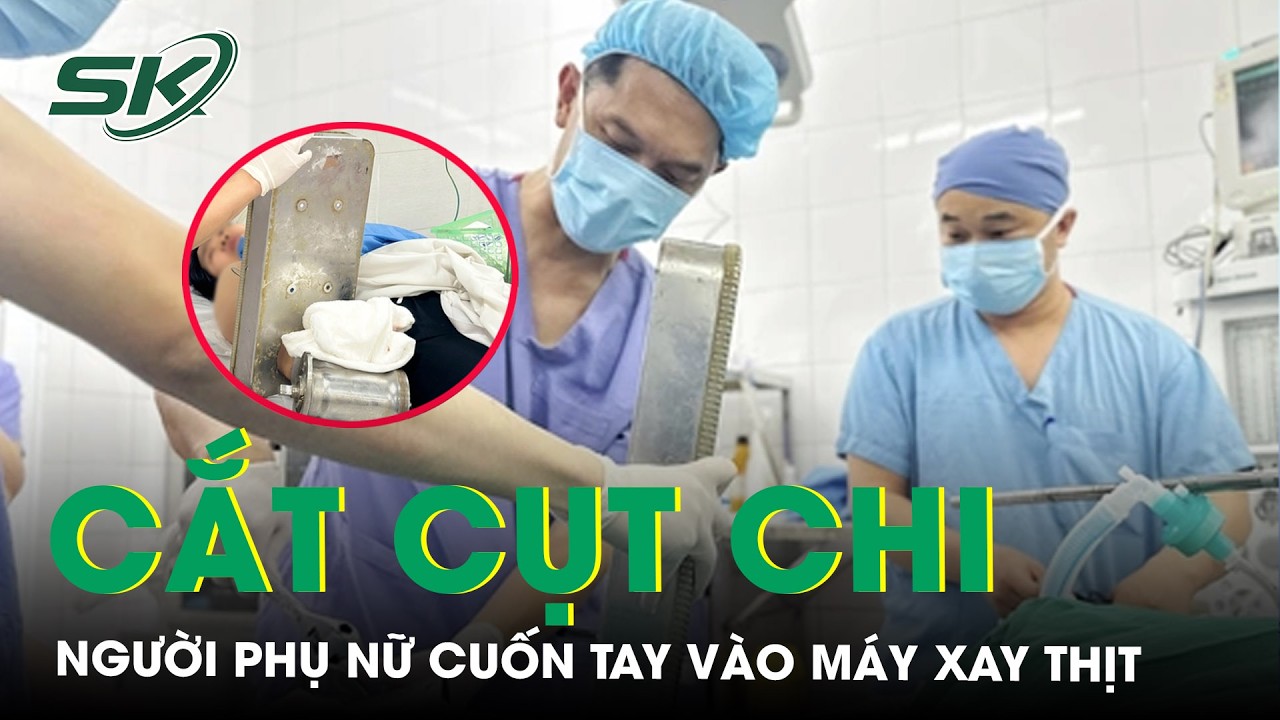 Cuốn tay vào máy xay thịt, người phụ nữ buộc phải cắt cụt chi để giữ mạng sống | SKĐS