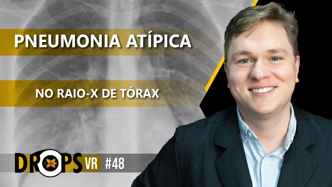 APRENDA COMO IDENTIFICAR UMA PNEUMONIA ATÍPICA NO RAIO X DE TÓRAX