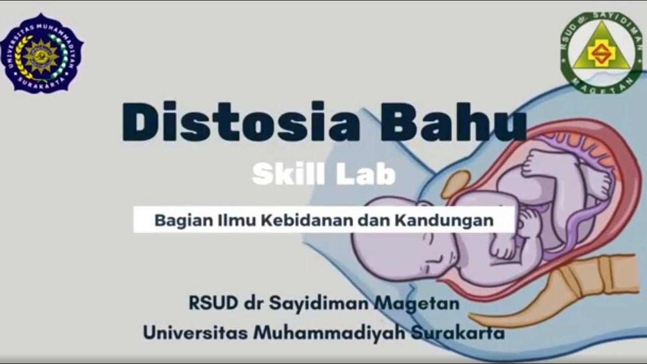 Distosia Bahu, dr  Mulya Kurniawan, Sp.OG