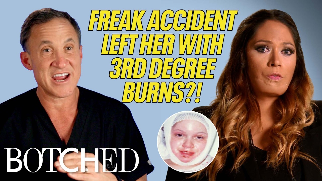 Dr. Nassif and Dr. Dubrow Make Cristina&rsquo;s Father Cry Tears of Joy (Before & After) | Botched | E!