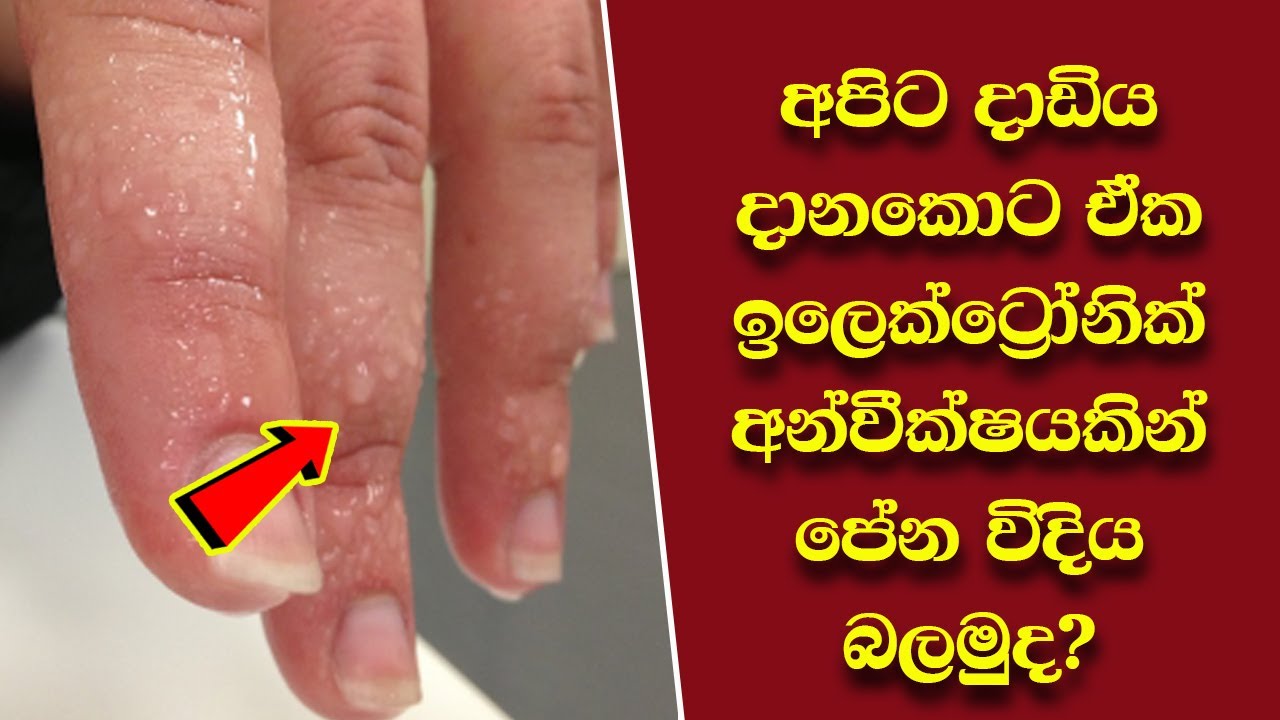 Mr.පුදුමයාගේ හොඳම short වීඩියෝ ටිකක් එක පෙලට EP:07