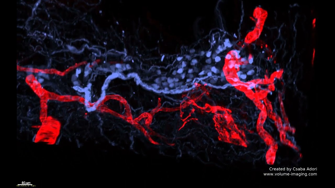 3D volume imaging - HEART MOVIE 6