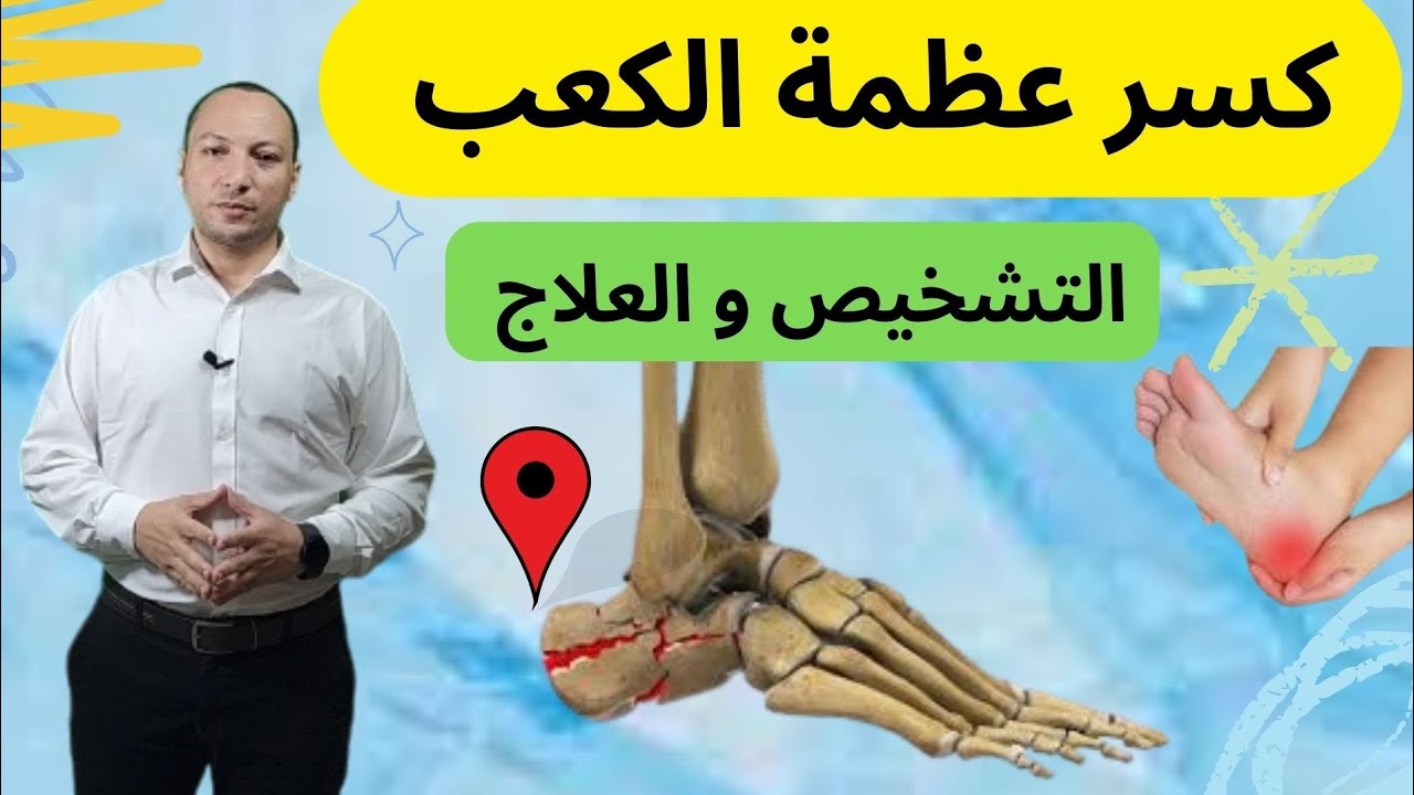 كسر عظمة الكعب calceneus fracture