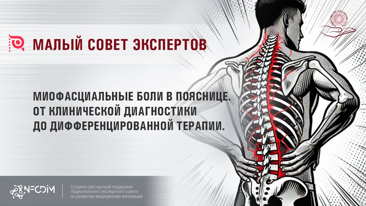 Миофасциальные боли в пояснице. От клинической диагностики до дифференцированной терапии.
