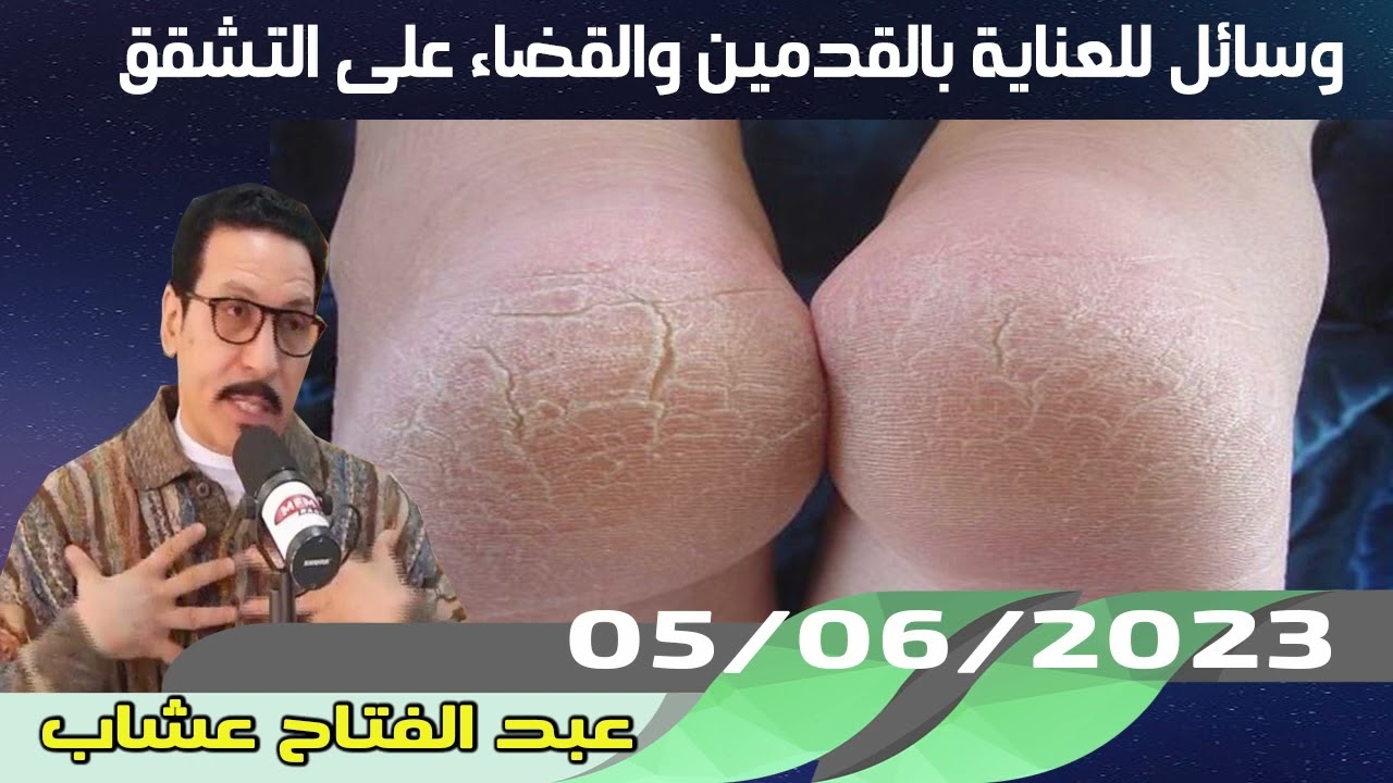 وسائل للعناية بالقدمين والقضاء على التشقق 05/06/2023 عبد الفتاح عشاب
