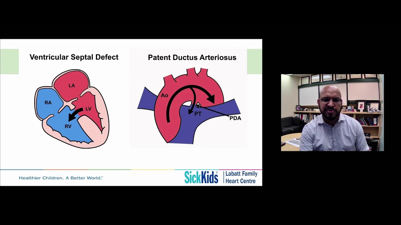 Dr. Aamir Jeewa: Heart failure in children with congenital heart disease