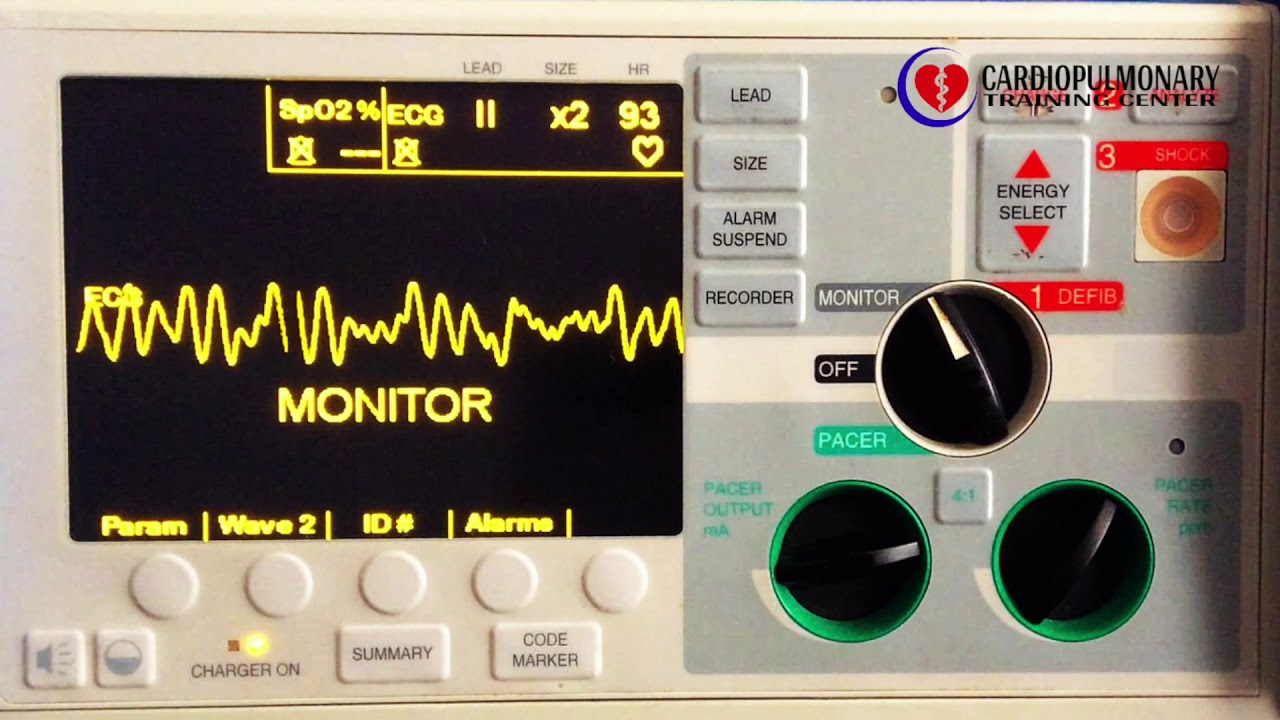 Fibrilación Ventricular
