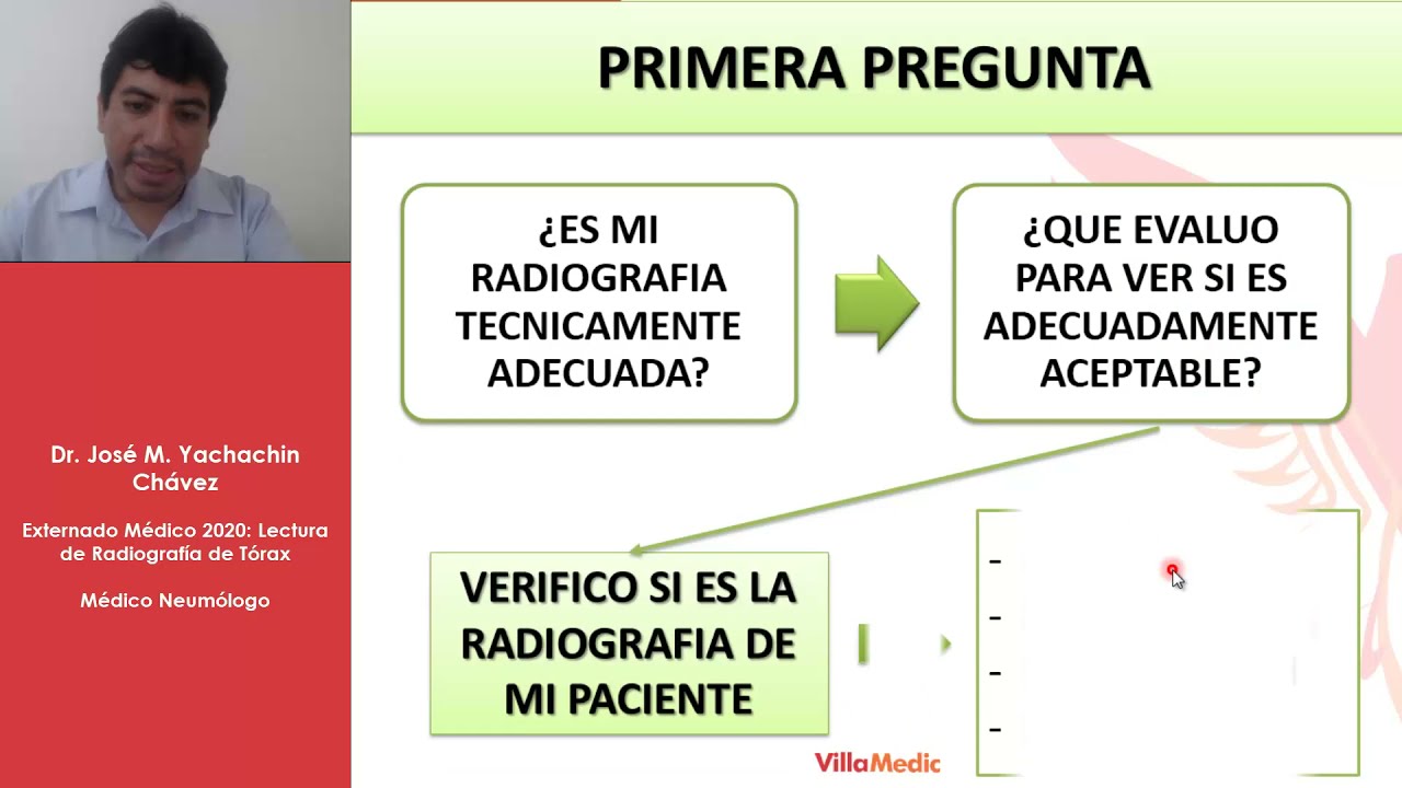 Lectura de Radiografía de Tórax