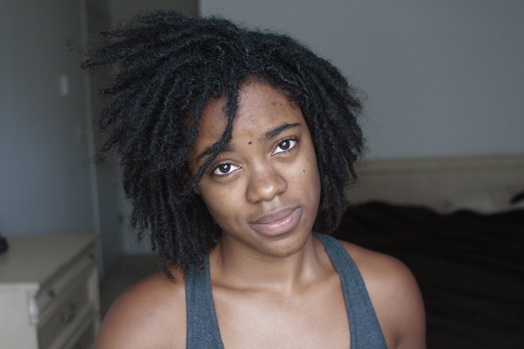 The Dangers of Interlocking Dreadlocks?
