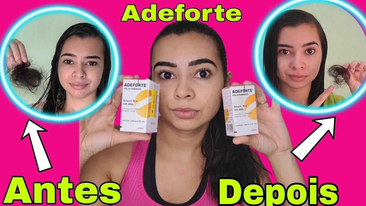 VITAMINA ADEFORTE PARA QUEDA DE CABELO, meu cabelo  estava caindo muito. 2° ampola após 2 MESES.